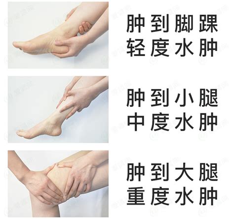 打乒乓球后脚疼
