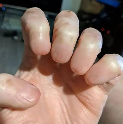 乒乓球用手指打球